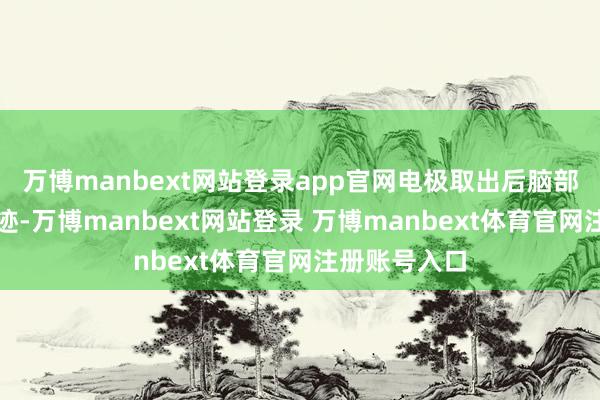 萬博manbext網(wǎng)站登錄app官網(wǎng)電極取出后腦部僅留微細(xì)印跡-萬博manbext網(wǎng)站登錄 萬博manbext體育官網(wǎng)注冊(cè)賬號(hào)入口